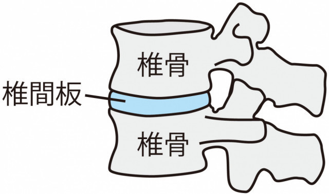 椎間板イラスト